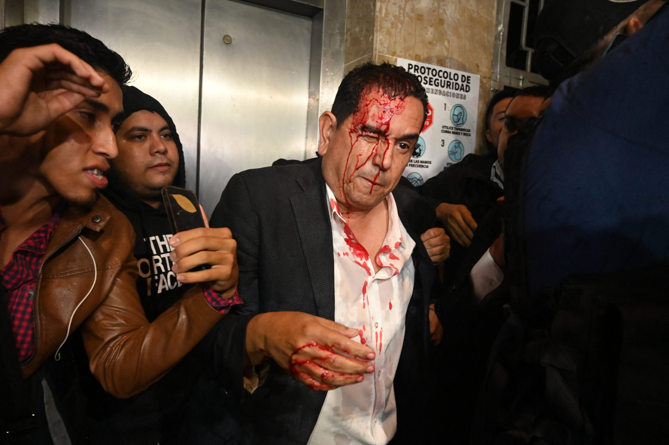Diputado Antonio Rivera resultó herido en los bajos del Congreso Nacional