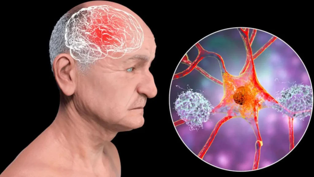 Este reciente descubrimiento podría transformar la manera en que se diagnostica y se trata el Alzheimer. Te contamos todos los detalles.