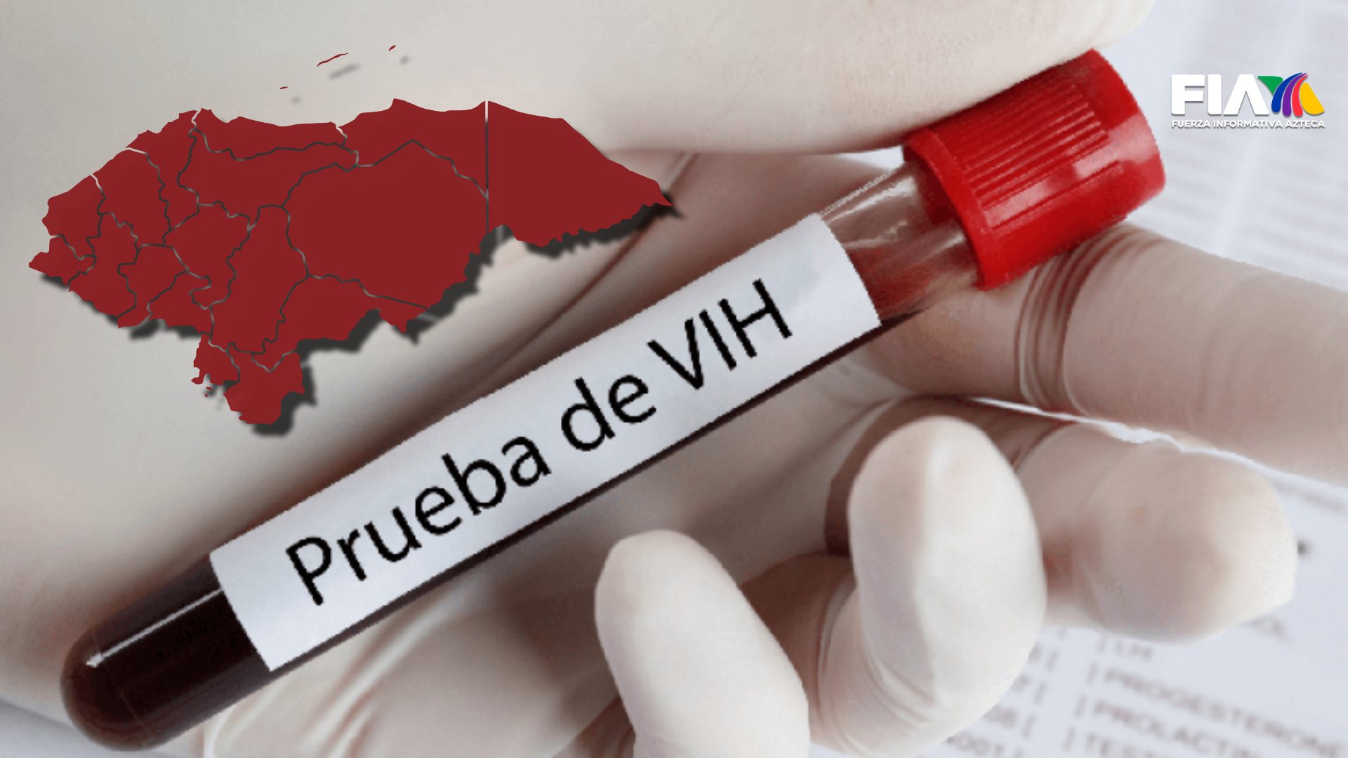 VIH en Honduras: síntomas y departamentos en alerta