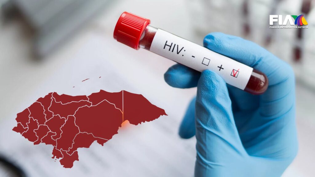VIH en Honduras: 8 departamentos en alerta