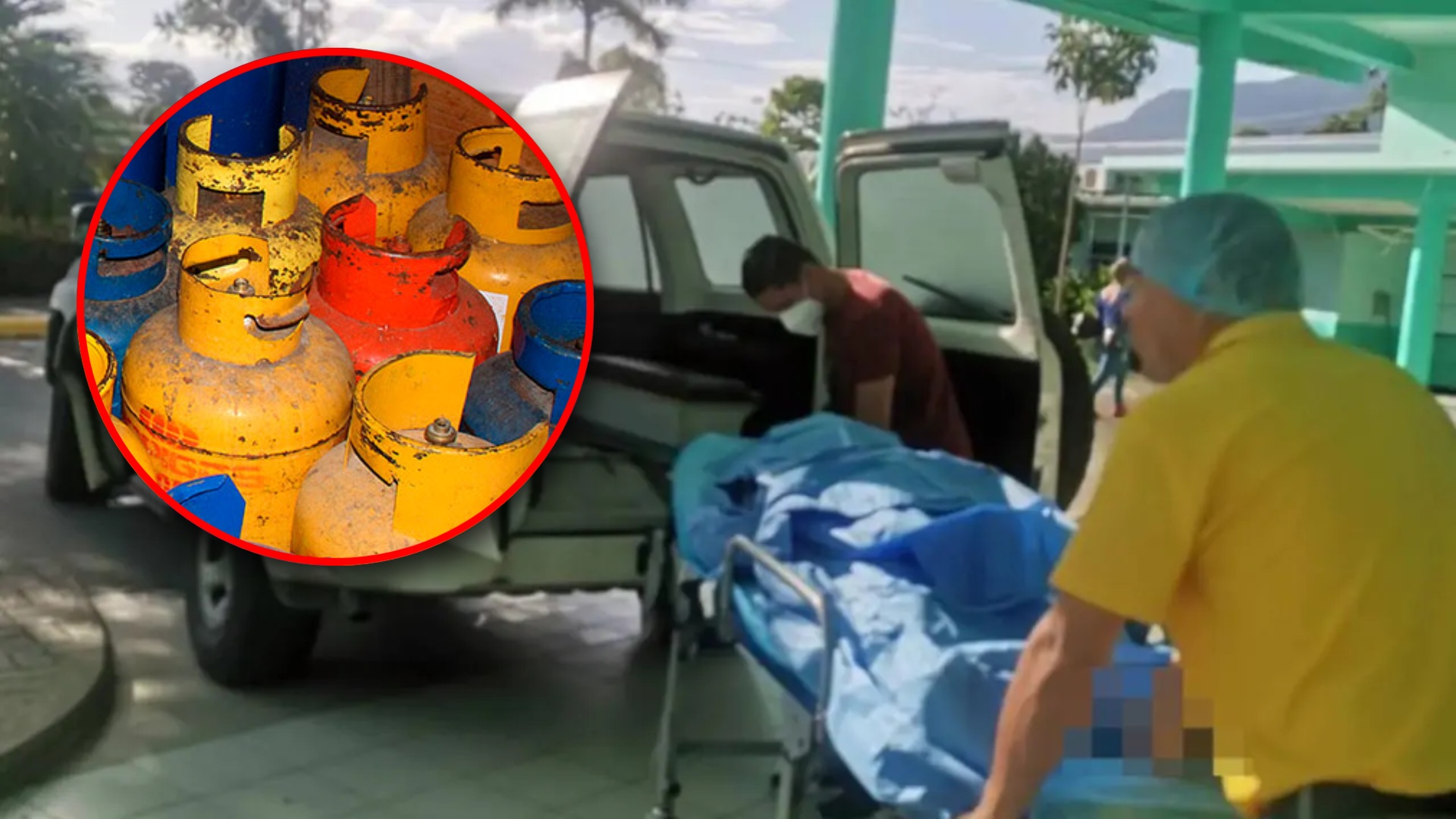 Pareja resulta con graves quemaduras por explosión de chumbo en La Ceiba