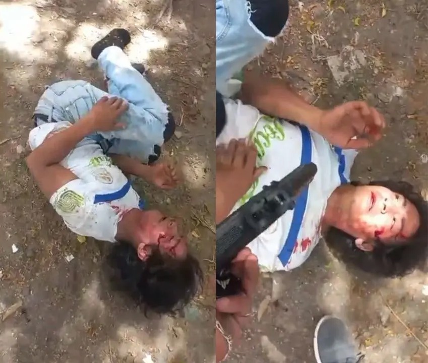 Foto cortesía: Joven golpeado por asaltar con pistola de juguete.