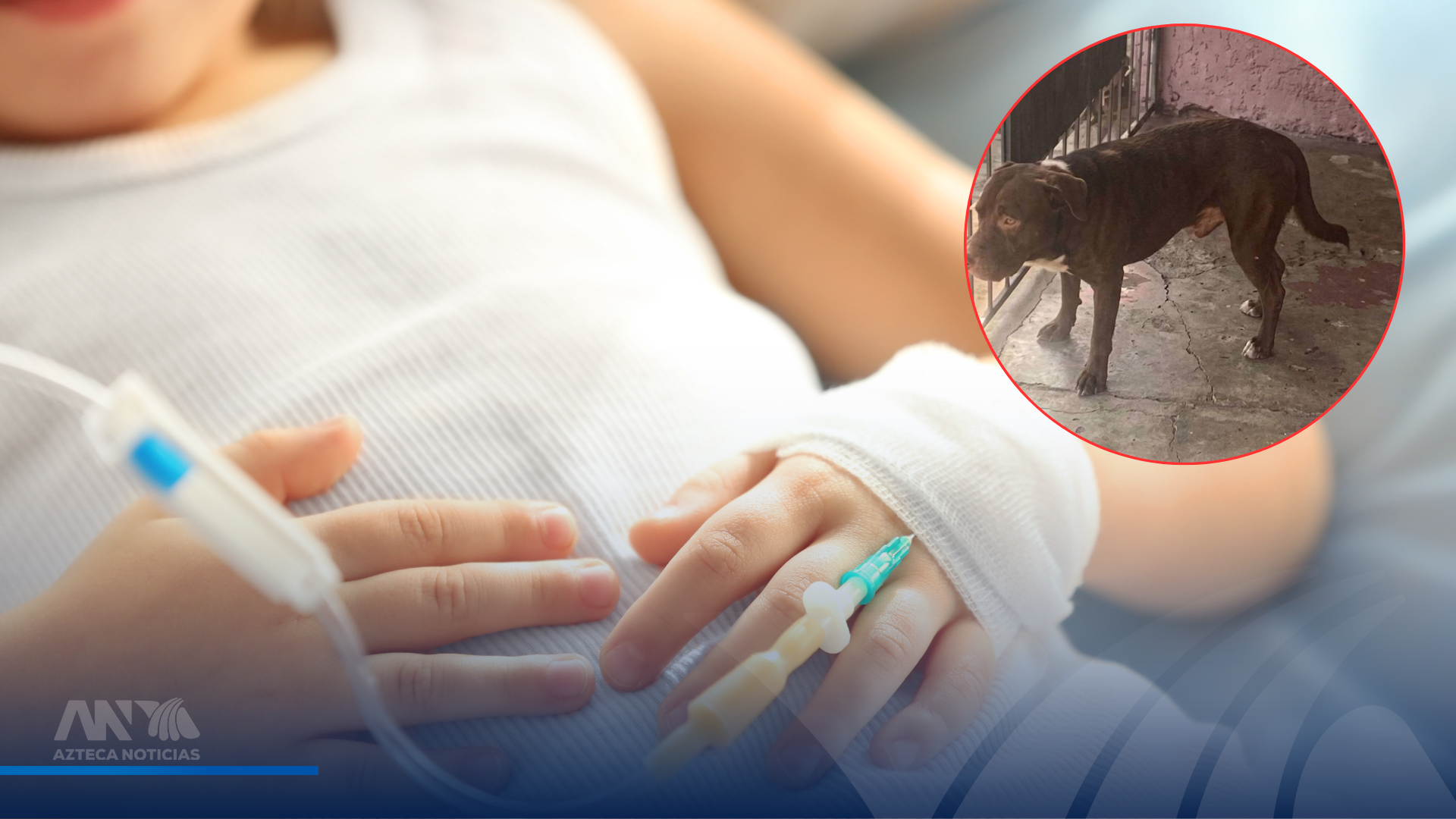 Lo que se sabe sobre la salud de la niña tras ataque de pitbull en SPS
