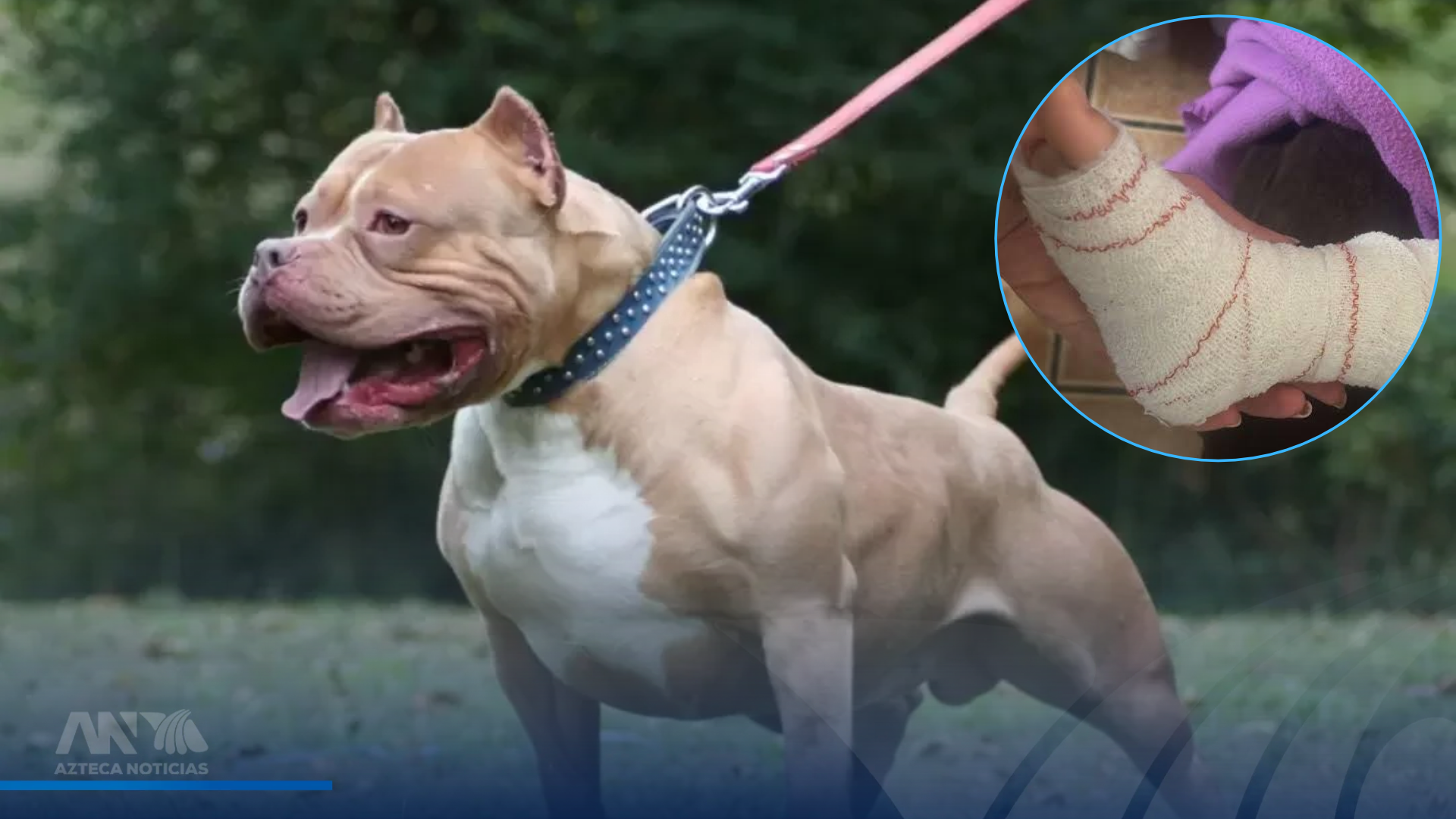 Niña de 10 años sufre graves heridas tras ataque de pitbull en San Pedro Sula